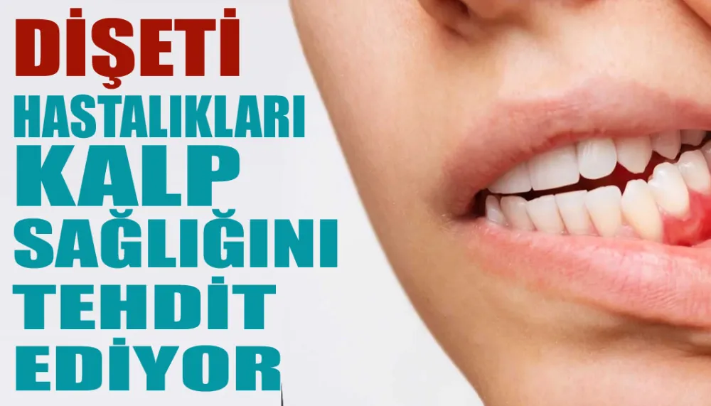 Dişeti hastalıkları kalp sağlığını tehdit ediyor