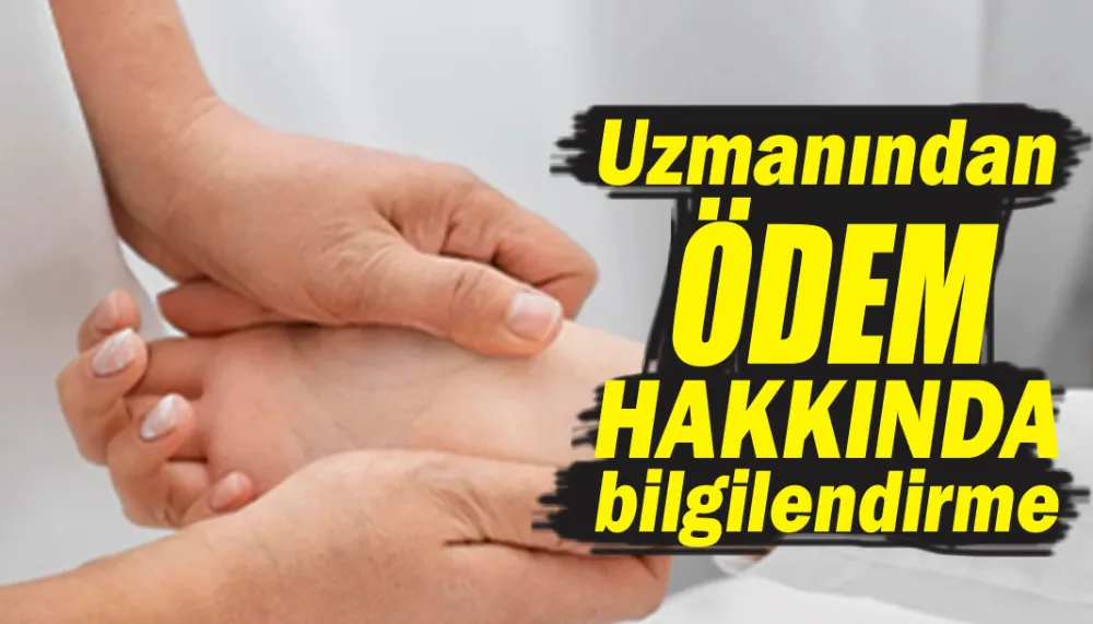 Uzmanından ödem hakkında bilgilendirme