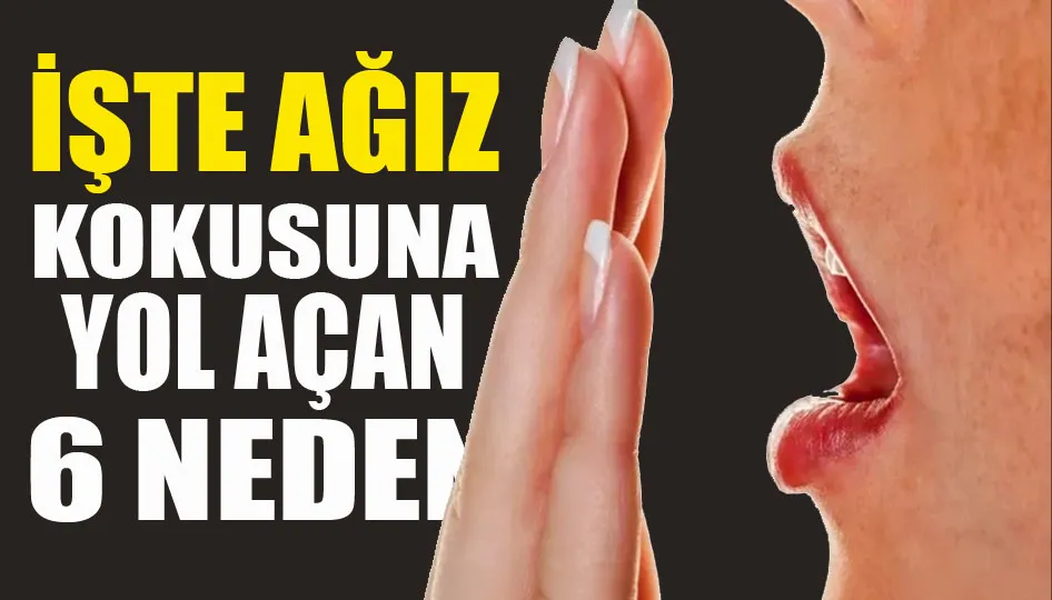 İşte ağız kokusuna yol açan 6 neden