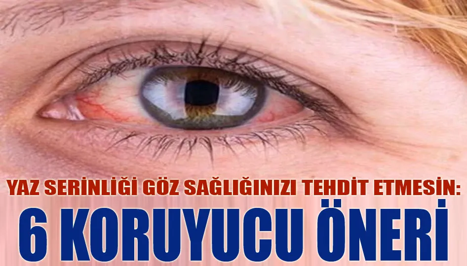 Yaz serinliği göz sağlığınızı tehdit etmesin: 6 koruyucu öneri