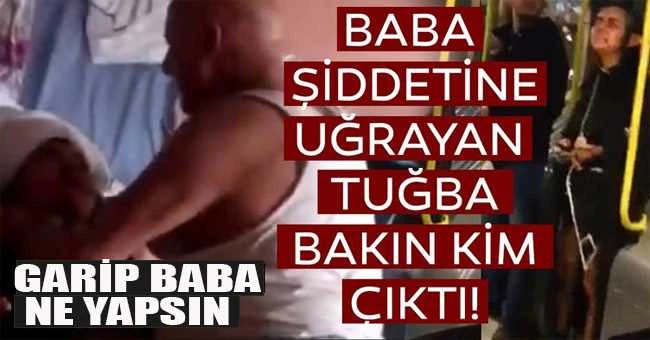 Baba şiddetine uğrayan genç kız tanıdık çıktı!